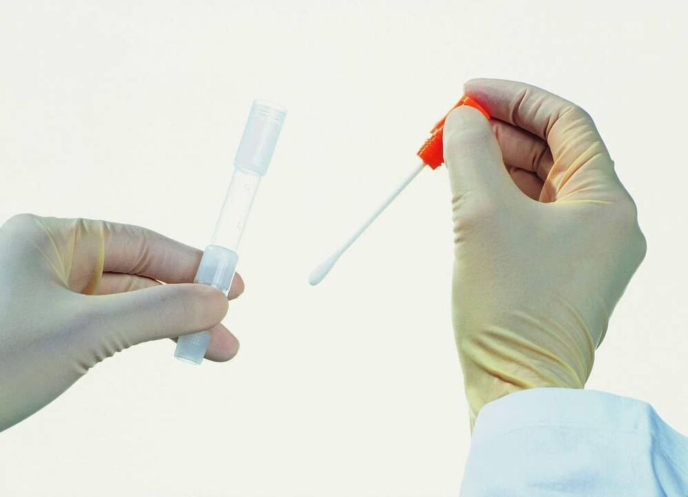 Raccolta di test per rilevare la prostatite cronica